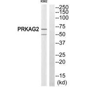 Western blot analysis of extracts from K562 cells, using PRKAG2 antiobdy.