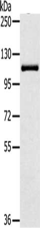 Gel: 6%SDS-PAGE, Lysate: 40 ug, Lane: HT29 cells, Primary antibody: CSB-PA147765(PTPN12 Antibody) at dilution 1/200, Secondary antibody: Goat anti rabbit IgG at 1/8000 dilution, Exposure time: 30 seconds