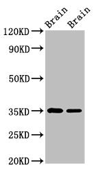 Western Blot Positive WB detected in: Rat brain tissue, Mouse brain tissue All lanes: Egln3 antibody at 3.6µg/ml Secondary Goat polyclonal to rabbit IgG at 1/50000 dilution Predicted band size: 28 kDa Observed band size: 35 kDa