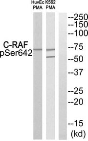 Western blot analysis of extracts from HuvEc cells and K562 cells treated with PMA using C-RAF (Phospho-Ser642) Antibody.The lane on the right is treated with the antigen-specific peptide.