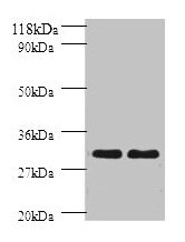Western blot All lanes: HLA-DPB1 antibody at 2µg/ml Lane 1: sw1990 whole cell lysate Lane 2: HGC27 whole cell lysate Secondary Goat polyclonal to rabbit IgG at 1/10000 dilution Predicted band size: 30 kDa Observed band size: 30 kDa