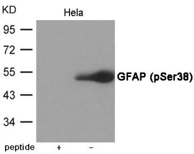 Western blot analysis of extracts from Hela cells using GFAP (Phospho-Ser38) Antibody.The lane on the left is treated with the antigen-specific peptide.
