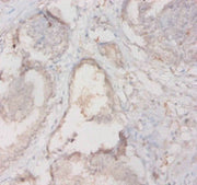 Immunohistochemistry of paraffin-embedded human prostate tissue using CSB-PA14829A0Rb at dilution of 1:20