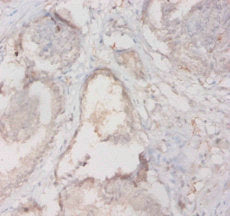 Immunohistochemistry of paraffin-embedded human prostate tissue using CSB-PA14829A0Rb at dilution of 1:20