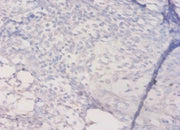 Immunohistochemistry of paraffin-embedded human prostate tissue using CSB-PA14839A0Rb at dilution of 1:50