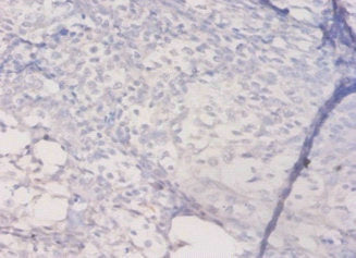 Immunohistochemistry of paraffin-embedded human prostate tissue using CSB-PA14839A0Rb at dilution of 1:50