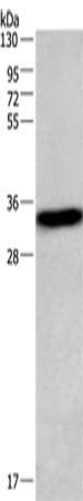 Gel: 6%SDS-PAGE, Lysate: 40 ug, Lane: Mouse liver tissue, Primary antibody: CSB-PA148580(CENPP Antibody) at dilution 1/373, Secondary antibody: Goat anti rabbit IgG at 1/8000 dilution, Exposure time: 1 second