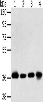 Gel: 8%SDS-PAGE, Lysate: 40 ug, Lane 1-4: Huvec cells, 293T cells, hepg2 cells, mouse liver tissue tissue, Primary antibody: CSB-PA148603(PDLIM1 Antibody) at dilution 1/600, Secondary antibody: Goat anti rabbit IgG at 1/8000 dilution, Exposure tim...