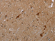 The image is immunohistochemistry of paraffin-embedded human brain tissue using CSB-PA148605(CASP8AP2 Antibody) at dilution 1/20. (Original magnification: ×200)