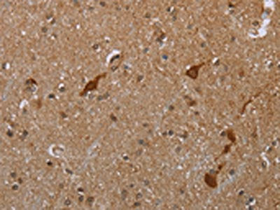 The image is immunohistochemistry of paraffin-embedded human brain tissue using CSB-PA148605(CASP8AP2 Antibody) at dilution 1/20. (Original magnification: ×200)