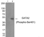 Western blot analysis of extracts from JK cells (Lane 2), using GATA2 (Phospho-Ser401) Antibody. The lane on the left is treated with antigen-specific peptide.
