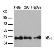 Western blot analysis of extracts from Hela, 293 and HepG2 cells using IkB-e(Ab-22) Antibody.