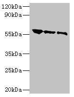 Western blot All lanes: Rabies virus Glycoprotein G antibody at 1: 500 Lane 1: Rabies virus antigen 1: 2 Lane 2: Rabies virus antigen 1: 10 Lane 3: Rabies virus antigen 1: 20 Secondary Goat polyclonal to rabbit IgG at 1/10000 dilution Predicted ba...