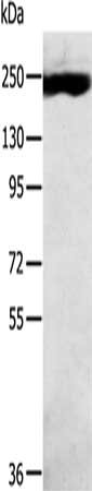 Gel: 6%SDS-PAGE, Lysate: 40 ug, Lane: K562 cells, Primary antibody: CSB-PA149000(MED13 Antibody) at dilution 1/300, Secondary antibody: Goat anti rabbit IgG at 1/8000 dilution, Exposure time: 10 minutes