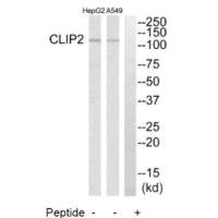 Western blot analysis of extracts from HepG2 cells and A549 cells, using CLIP2 antibody.