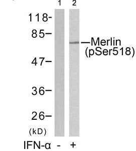 Western blot analysis of extracts from HUVEC cells untreated(lane 1) or treated with IFN-a(lane 2) using Merlin(Phospho-Ser518) Antibody.