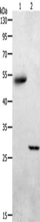 Gel: 10%SDS-PAGE, Lysate: 40 ug, Lane 1-2: Human liver cancer tissue, mouse skeletal muscle tissue, Primary antibody: CSB-PA149289(ADIPOQ Antibody) at dilution 1/550, Secondary antibody: Goat anti rabbit IgG at 1/8000 dilution, Exposure time: 2 mi...