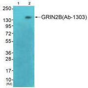 Western blot analysis of extracts from 3T3 cells (Lane 2), using GRIN2B (Ab-1303) antiobdy. The lane on the left is treated with synthesized peptide.