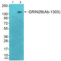 Western blot analysis of extracts from 3T3 cells (Lane 2), using GRIN2B (Ab-1303) antiobdy. The lane on the left is treated with synthesized peptide.