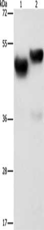 Gel: 8%SDS-PAGE, Lysate: 40 ug, Lane 1-2: Human fetal brain tissue, Human liver tissue, Primary antibody: CSB-PA149856(AMZ1 Antibody) at dilution 1/1000, Secondary antibody: Goat anti rabbit IgG at 1/8000 dilution, Exposure time: 2 minutes