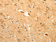 The image on the left is immunohistochemistry of paraffin-embedded Human brain tissue using CSB-PA150036(PTPN6 Antibody) at dilution 1/40, on the right is treated with fusion protein. (Original magnification: ×200)