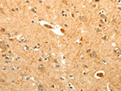 The image on the left is immunohistochemistry of paraffin-embedded Human brain tissue using CSB-PA150036(PTPN6 Antibody) at dilution 1/40, on the right is treated with fusion protein. (Original magnification: ×200)