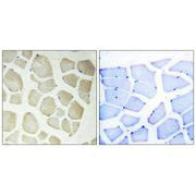 Immunohistochemistry analysis of paraffin-embedded human skeletal muscle tissue, using CDKL3 antibody.