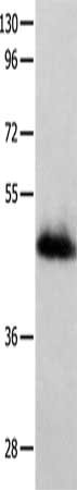 Gel: 10%SDS-PAGE, Lysate: 60 ug, Lane: Human liver cancer tissue, Primary antibody: CSB-PA150222(GFRA2 Antibody) at dilution 1/250, Secondary antibody: Goat anti rabbit IgG at 1/8000 dilution, Exposure time: 1 minute
