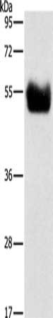 Gel: 8%SDS-PAGE, Lysate: 100 ug, Lane: Human fetal brain tissue, Primary antibody: CSB-PA150463(BACE1 Antibody) at dilution 1/500, Secondary antibody: Goat anti rabbit IgG at 1/8000 dilution, Exposure time: 1 minute