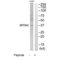 Western blot analysis of extracts from COS7 cells, using SPON2 antibody.