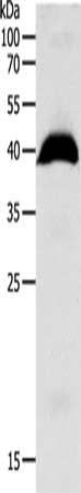 Gel: 10%SDS-PAGE, Lysate: 40 ug, Lane: Human liver cancer tissue, Primary antibody: CSB-PA150690(OPRL1 Antibody) at dilution 1/1100, Secondary antibody: Goat anti rabbit IgG at 1/8000 dilution, Exposure time: 1 minute