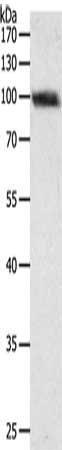 Gel: 8%SDS-PAGE, Lysate: 40 ug, Lane: SKOV3 cells, Primary antibody: CSB-PA150915(PYGB Antibody) at dilution 1/300, Secondary antibody: Goat anti rabbit IgG at 1/8000 dilution, Exposure time: 30 seconds