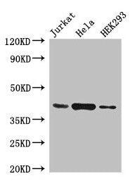 Western Blot Positive WB detected in: Jurkat whole cell lysate, Hela whole cell lysate, HEK293 whole cell lysate All lanes: HLA-C antibody at 4µg/ml Secondary Goat polyclonal to rabbit IgG at 1/50000 dilution Predicted band size: 41 kDa Observed b...