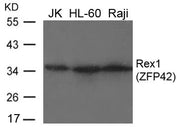 Western blot analysis of extracts from JK, HL-60 and Raji cells using Rex1(ZFP42) Antibody.