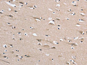 The image on the left is immunohistochemistry of paraffin-embedded Human brain tissue using CSB-PA151388(DLG2 Antibody) at dilution 1/35, on the right is treated with synthetic peptide. (Original magnification: ×200)