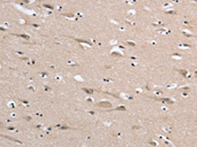 The image on the left is immunohistochemistry of paraffin-embedded Human brain tissue using CSB-PA151388(DLG2 Antibody) at dilution 1/35, on the right is treated with synthetic peptide. (Original magnification: ×200)