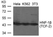 Western blot analysis of extracts from Hela, K562 and 3T3 cells using HNF-1b(TCF-2) Antibody.