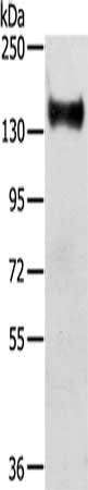 Gel: 6%SDS-PAGE, Lysate: 40 ug, Lane: Mouse brain tissue, Primary antibody: CSB-PA151979(RASAL2 Antibody) at dilution 1/350, Secondary antibody: Goat anti rabbit IgG at 1/8000 dilution, Exposure time: 10 seconds