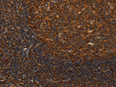 The image on the left is immunohistochemistry of paraffin-embedded Human tonsil tissue using CSB-PA152107(MIP Antibody) at dilution 1/40, on the right is treated with synthetic peptide. (Original magnification: ×200)