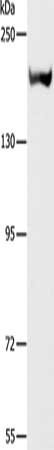 Gel: 6%SDS-PAGE, Lysate: 40 ug, Lane: Mouse kidney tissue, Primary antibody: CSB-PA152113(ACE Antibody) at dilution 1/1000, Secondary antibody: Goat anti rabbit IgG at 1/8000 dilution, Exposure time: 30 seconds