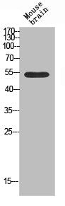 Western blot analysis of mouse-brain using TASK-1 antibody. Antibody was diluted at 1:500. Secondary antibody was diluted at 1:20000