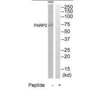 Western blot analysis of extracts from K562 and HuvEc cells, using PARP2 antibody.