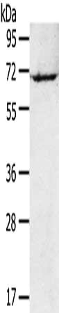 Gel: 8%SDS-PAGE,Lysate: 40 ug,,Primary antibody: CSB-PA152342(RAD17 Antibody) at dilution 1/200 dilution,Secondary antibody: Goat anti rabbit IgG at 1/8000 dilution,Exposure time: 1 minute
