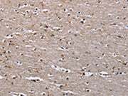 The image on the left is immunohistochemistry of paraffin-embedded Human brain tissue using CSB-PA152363(IQCJ Antibody) at dilution 1/30, on the right is treated with synthetic peptide. (Original magnification: ×200)