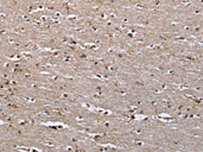 The image on the left is immunohistochemistry of paraffin-embedded Human brain tissue using CSB-PA152363(IQCJ Antibody) at dilution 1/30, on the right is treated with synthetic peptide. (Original magnification: ×200)