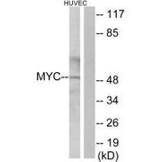 Western blot analysis of extracts from HUVEC cells, using Myc antibody.