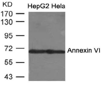 Western blot analysis of extracts from HepG2 andd Hela cells us ing Annexin VI Antibody.