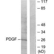 Western blot analysis of extracts from NIH/3T3 cells, using PDGFB antibody.