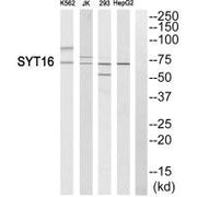 Western blot analysis of extracts from K562 cells, Jurkat cells, 293 cells and HepG2 cells, using SYT16 antibody.
