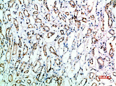 Immunohistochemical analysis of paraffin-embedded human-kidney, antibody was diluted at 1:200